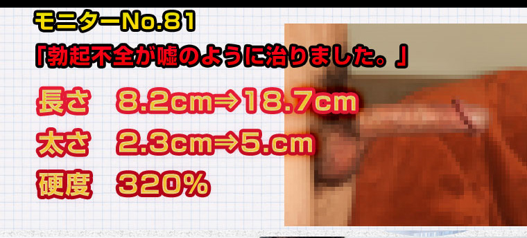 CATEGORY X（カテゴリーエックス）